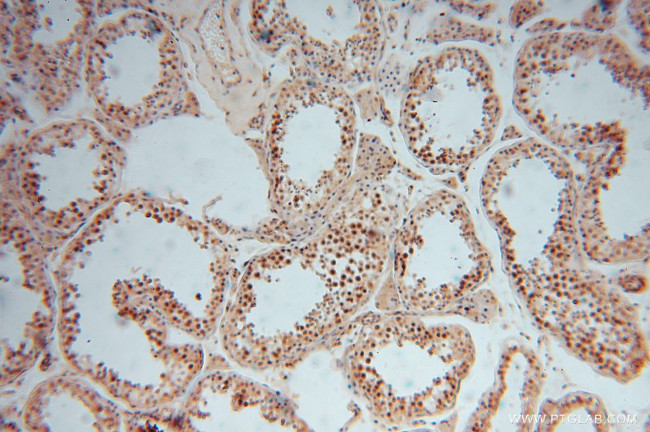 GNB3 Antibody in Immunohistochemistry (Paraffin) (IHC (P))