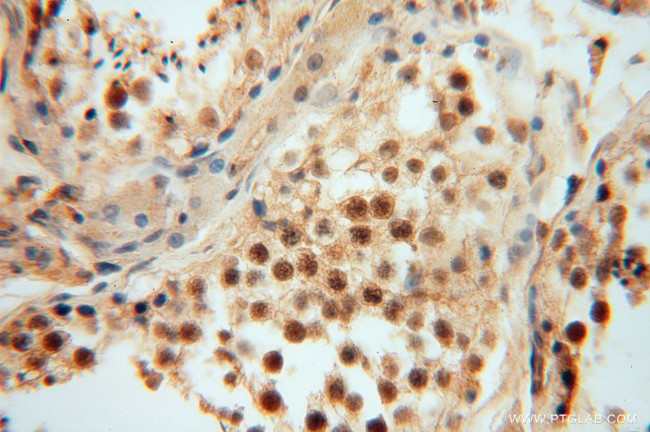 GNB3 Antibody in Immunohistochemistry (Paraffin) (IHC (P))