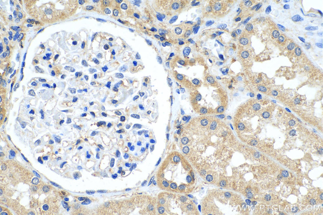 GNB3 Antibody in Immunohistochemistry (Paraffin) (IHC (P))