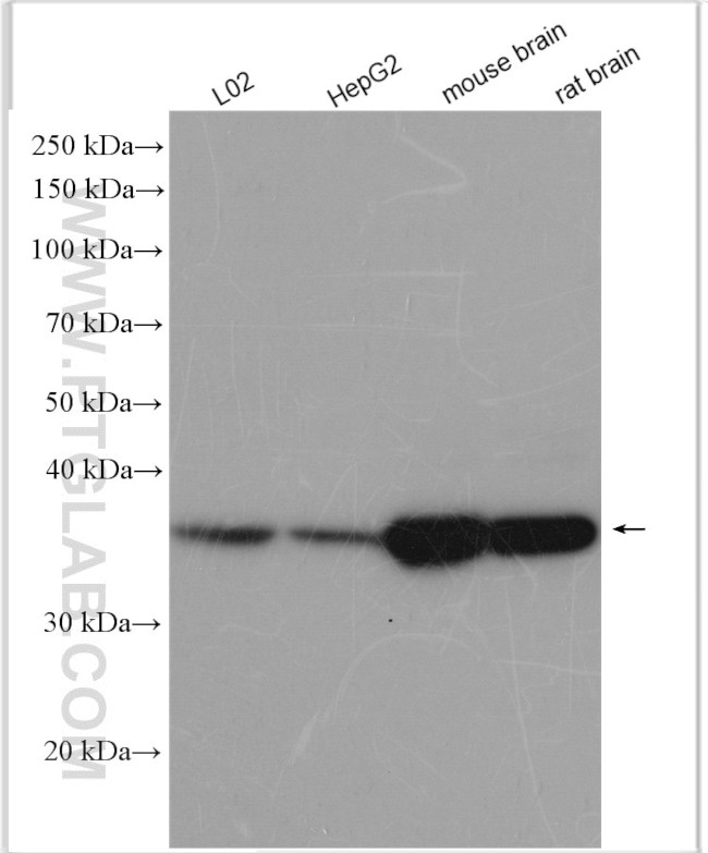 GNB3 Antibody in Western Blot (WB)