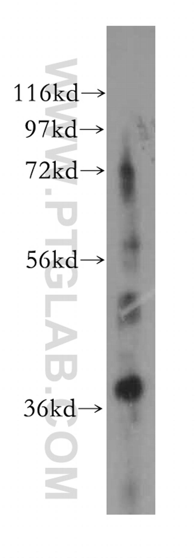 GNB3 Antibody in Western Blot (WB)