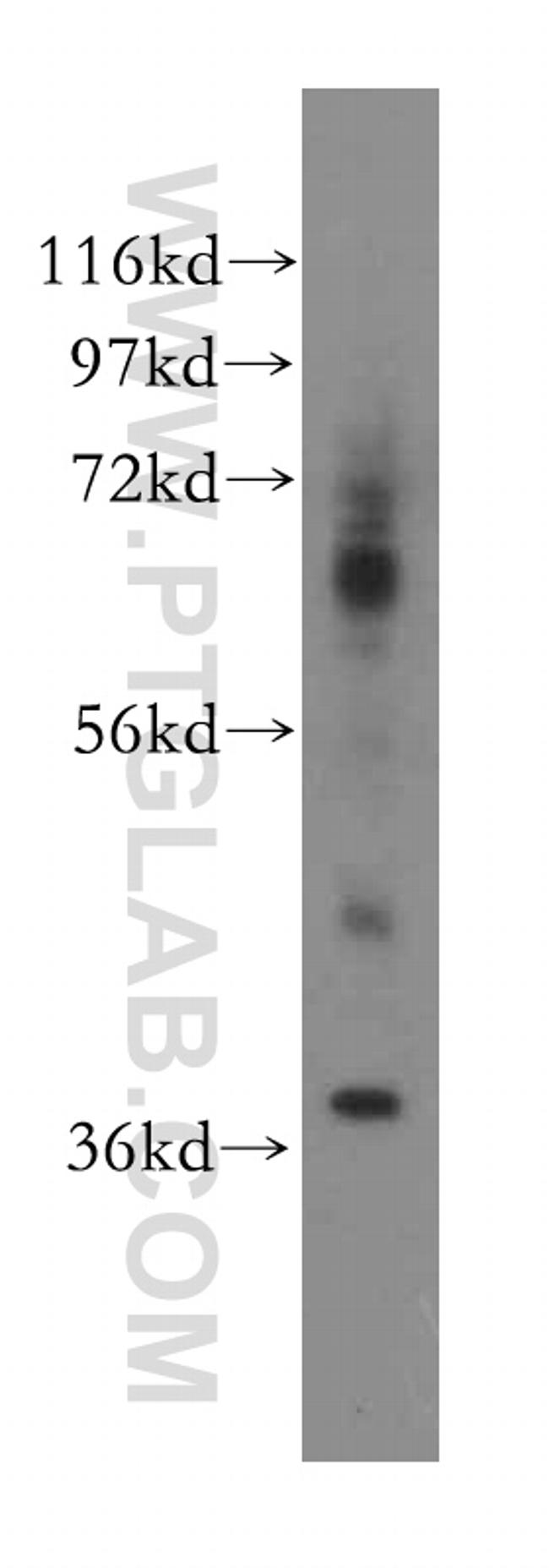 GNB3 Antibody in Western Blot (WB)