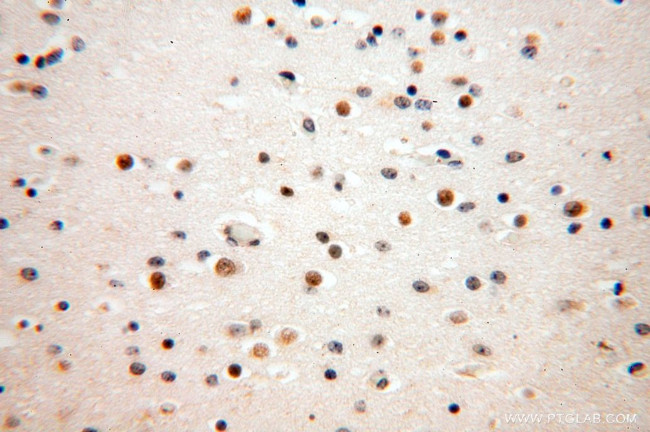 BRCC3 Antibody in Immunohistochemistry (Paraffin) (IHC (P))