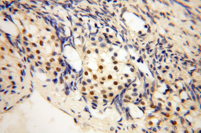 BRCC3 Antibody in Immunohistochemistry (Paraffin) (IHC (P))