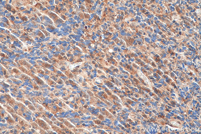 BRCC3 Antibody in Immunohistochemistry (Paraffin) (IHC (P))