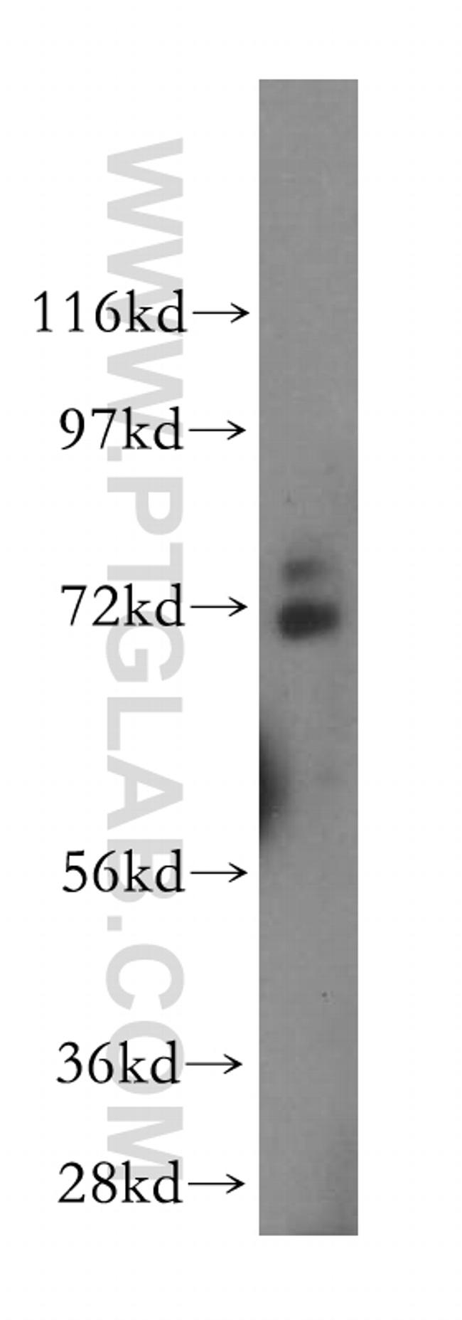 BRCC3 Antibody in Western Blot (WB)