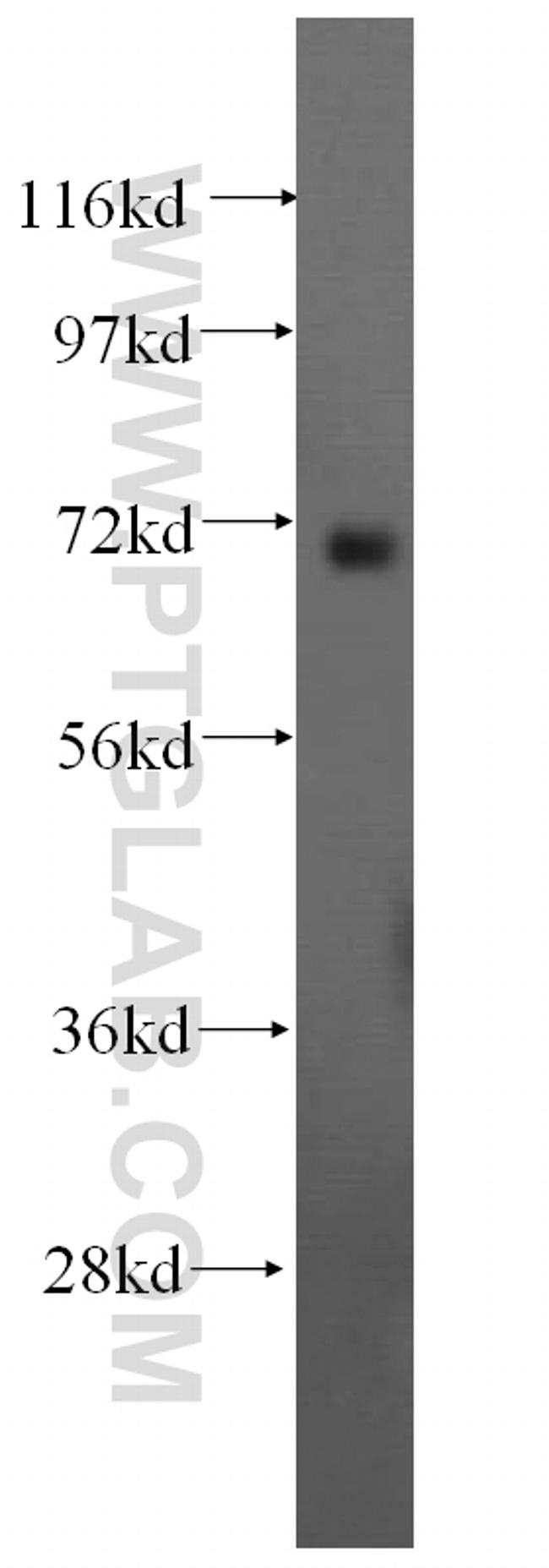 BRCC3 Antibody in Western Blot (WB)