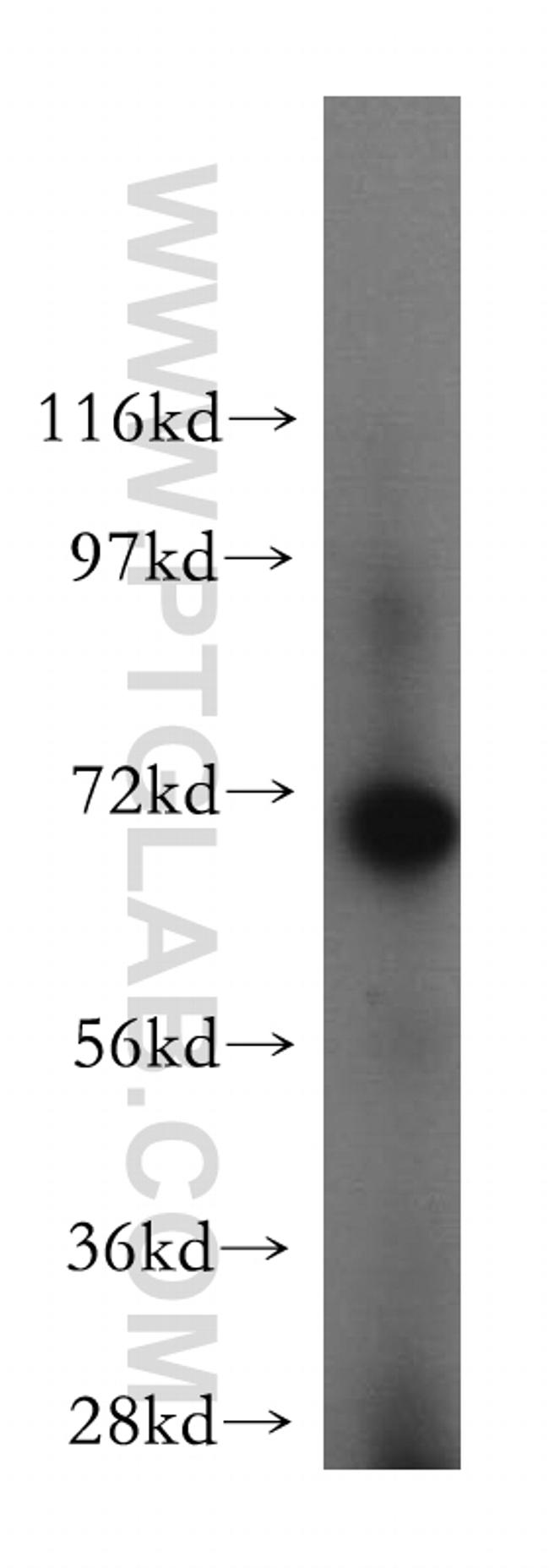 BRCC3 Antibody in Western Blot (WB)