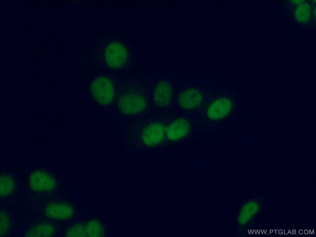 PRMT6 Antibody in Immunocytochemistry (ICC/IF)