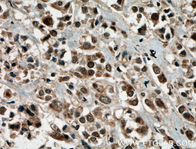 PRMT6 Antibody in Immunohistochemistry (Paraffin) (IHC (P))