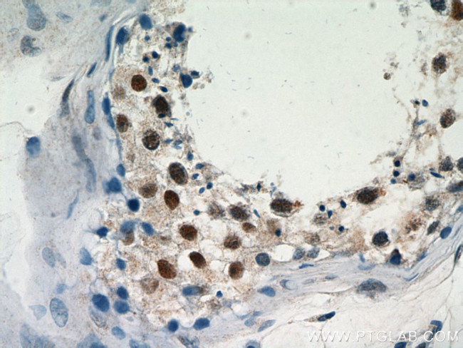 PRMT6 Antibody in Immunohistochemistry (Paraffin) (IHC (P))