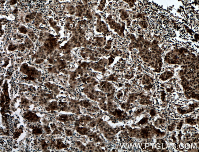 PRMT6 Antibody in Immunohistochemistry (Paraffin) (IHC (P))