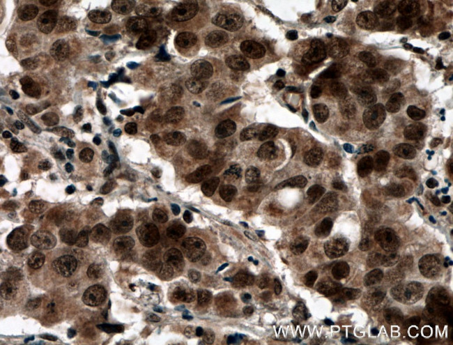 PRMT6 Antibody in Immunohistochemistry (Paraffin) (IHC (P))