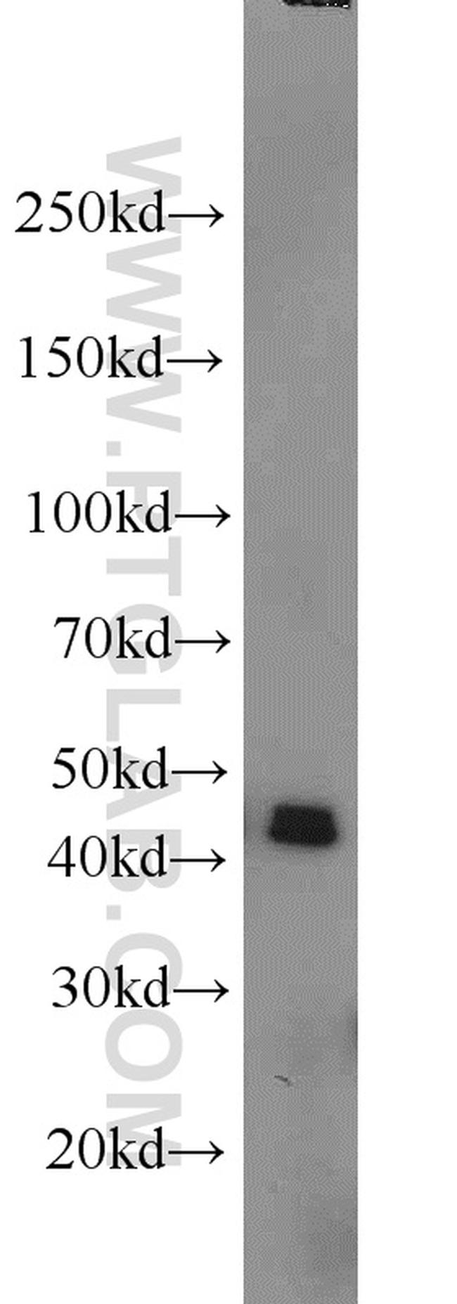 PRMT6 Antibody in Western Blot (WB)