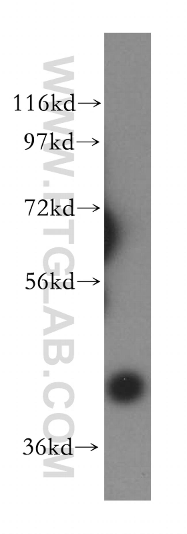 PRMT6 Antibody in Western Blot (WB)