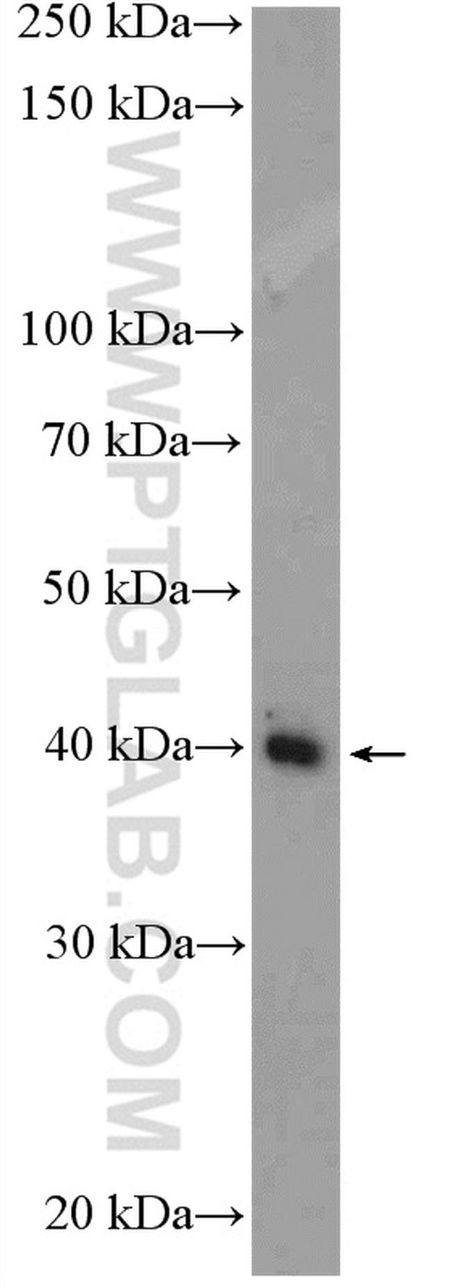 PRMT6 Antibody in Western Blot (WB)