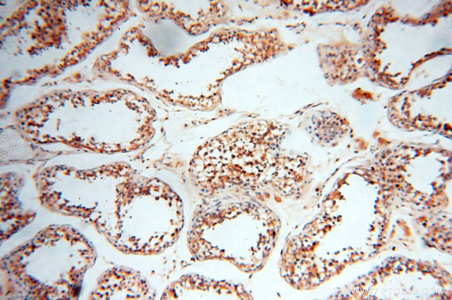 SEC13 Antibody in Immunohistochemistry (Paraffin) (IHC (P))