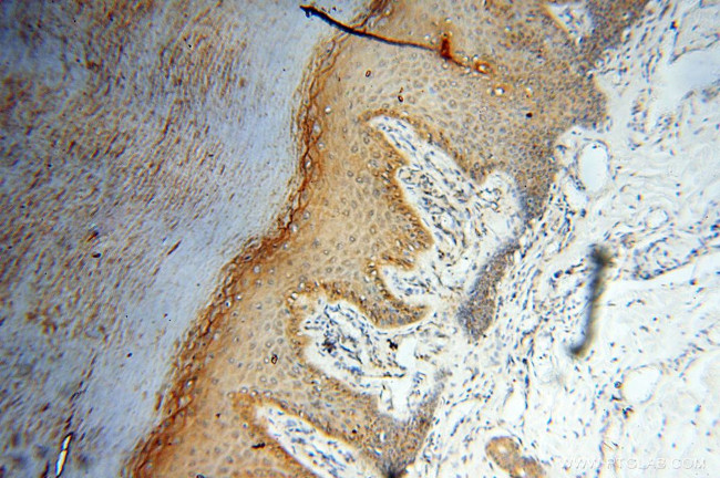 SEC13 Antibody in Immunohistochemistry (Paraffin) (IHC (P))