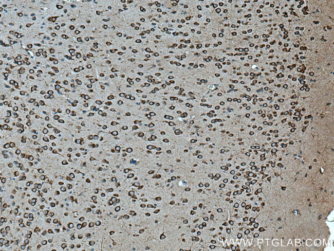 SEC13 Antibody in Immunohistochemistry (Paraffin) (IHC (P))