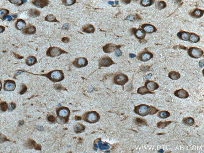 SEC13 Antibody in Immunohistochemistry (Paraffin) (IHC (P))