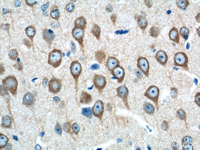 SEC13 Antibody in Immunohistochemistry (Paraffin) (IHC (P))