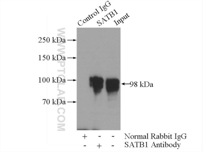 SATB1 Antibody in Immunoprecipitation (IP)