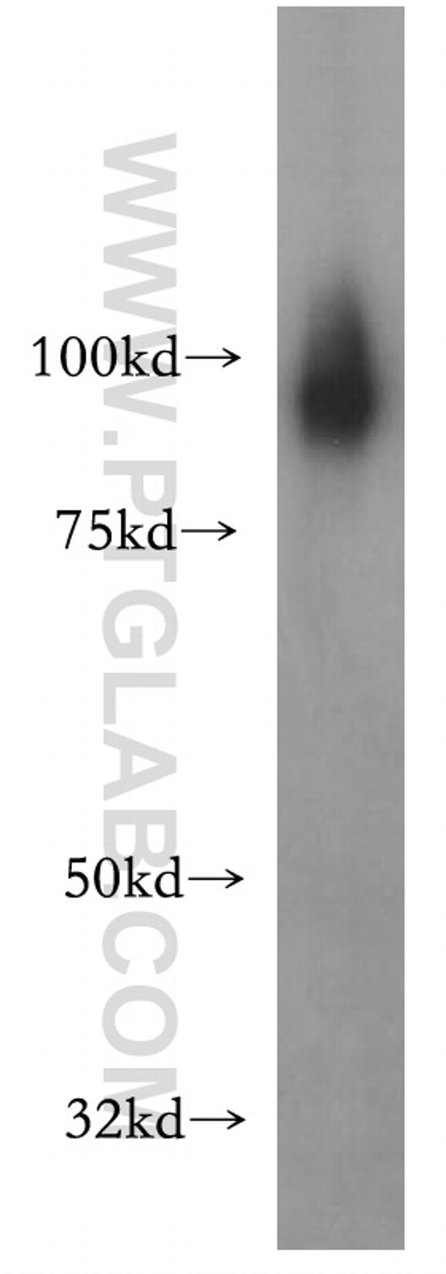 SATB1 Antibody in Western Blot (WB)