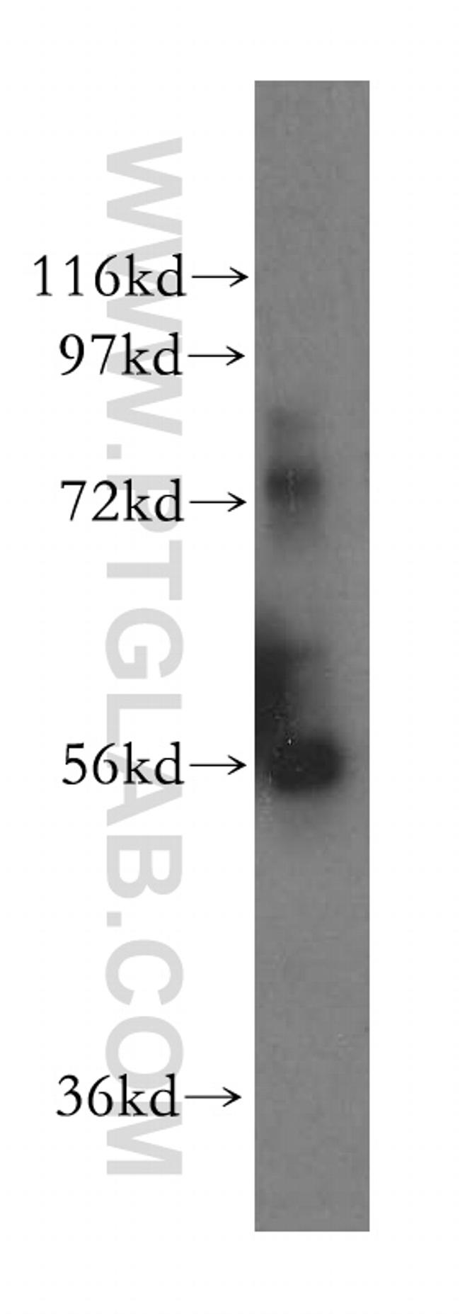 PPAT Antibody in Western Blot (WB)