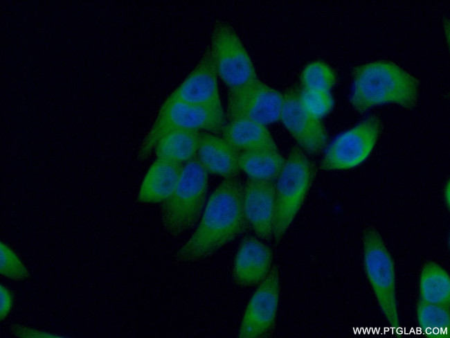 NUBP2 Antibody in Immunocytochemistry (ICC/IF)