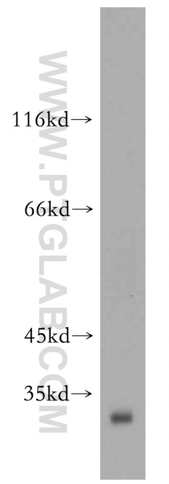 NUBP2 Antibody in Western Blot (WB)