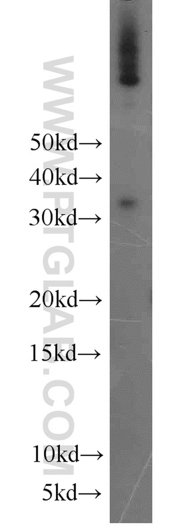 NUBP2 Antibody in Western Blot (WB)