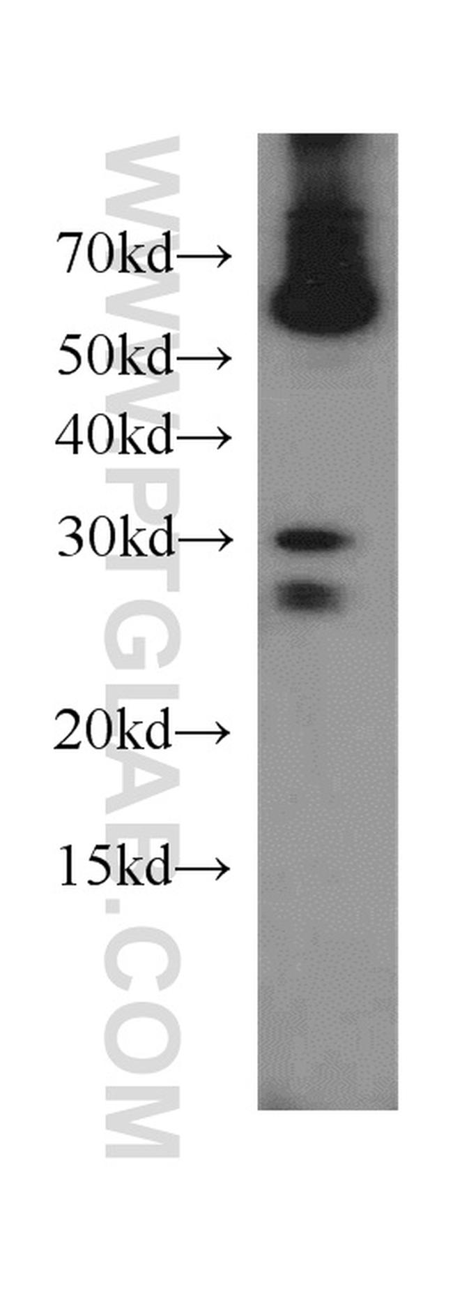 NUBP2 Antibody in Western Blot (WB)