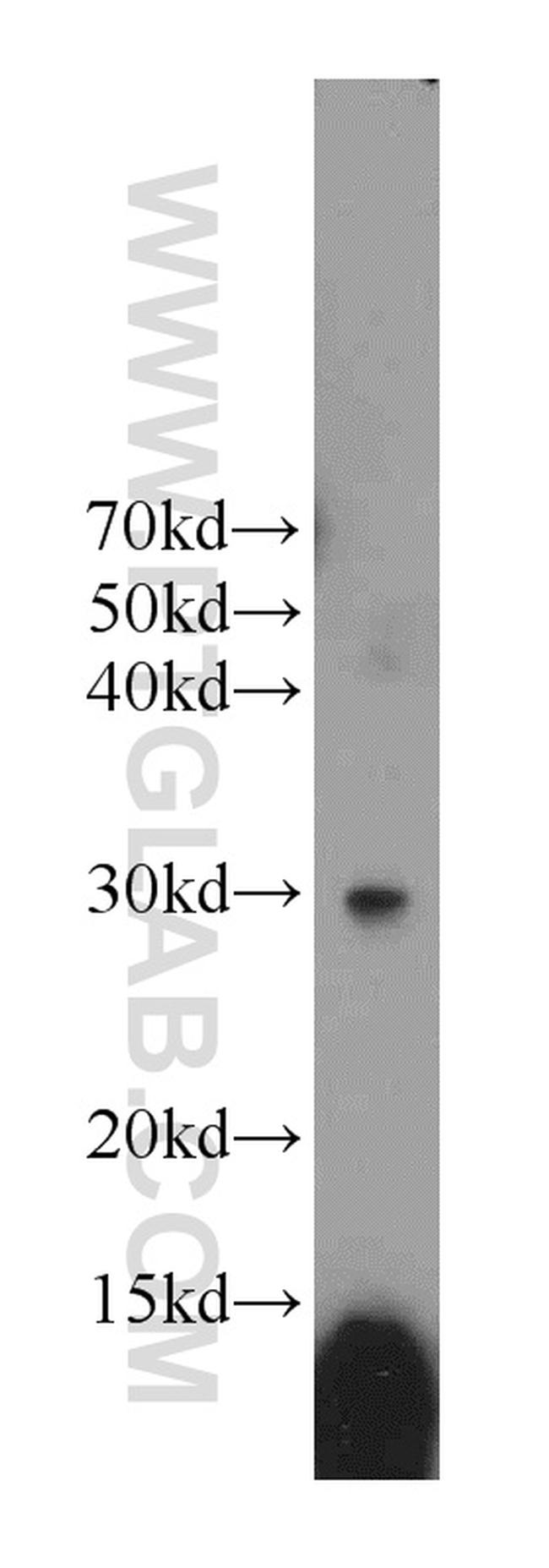 NUBP2 Antibody in Western Blot (WB)