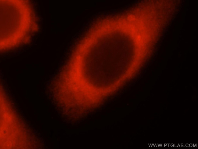 SYT17 Antibody in Immunocytochemistry (ICC/IF)