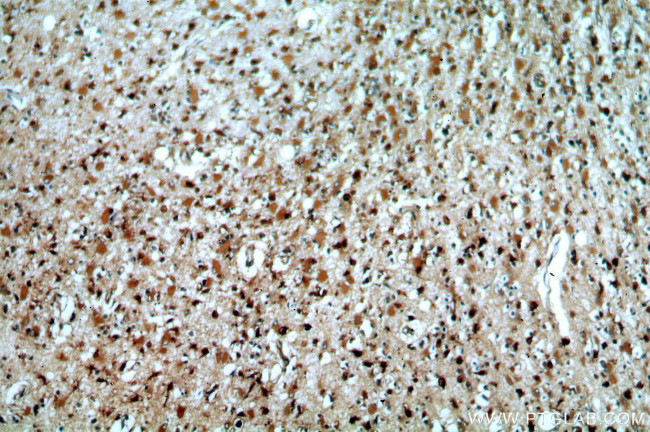 SYT17 Antibody in Immunohistochemistry (Paraffin) (IHC (P))