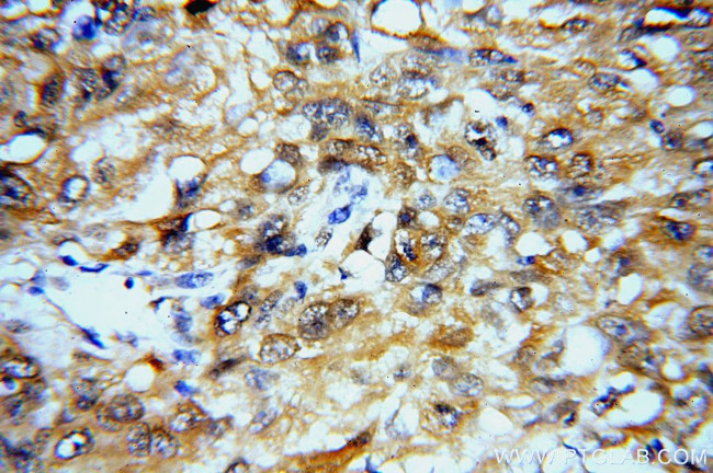 SYT17 Antibody in Immunohistochemistry (Paraffin) (IHC (P))