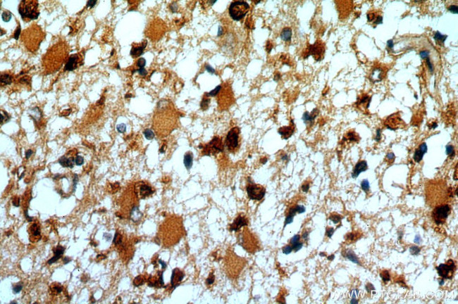 SYT17 Antibody in Immunohistochemistry (Paraffin) (IHC (P))