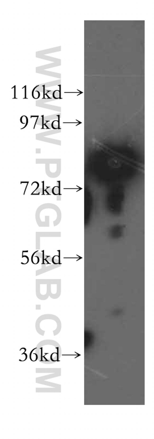 SYT17 Antibody in Western Blot (WB)