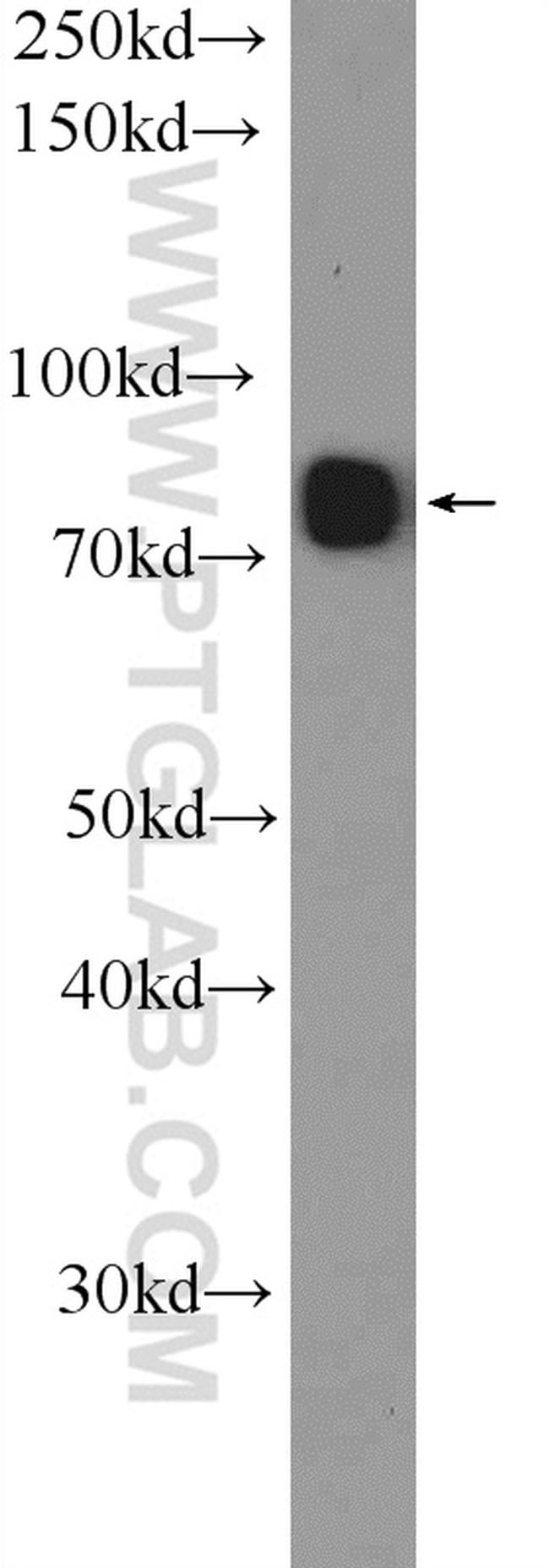 SYT17 Antibody in Western Blot (WB)