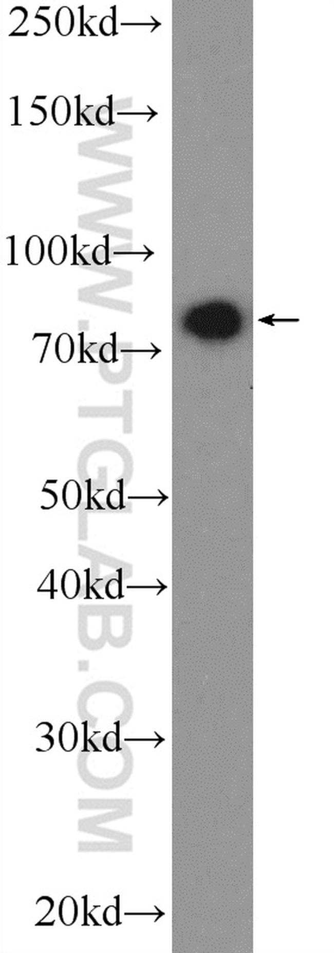 SYT17 Antibody in Western Blot (WB)