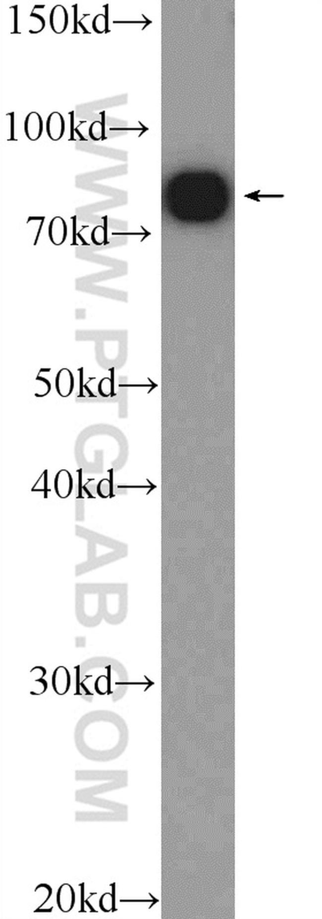 SYT17 Antibody in Western Blot (WB)