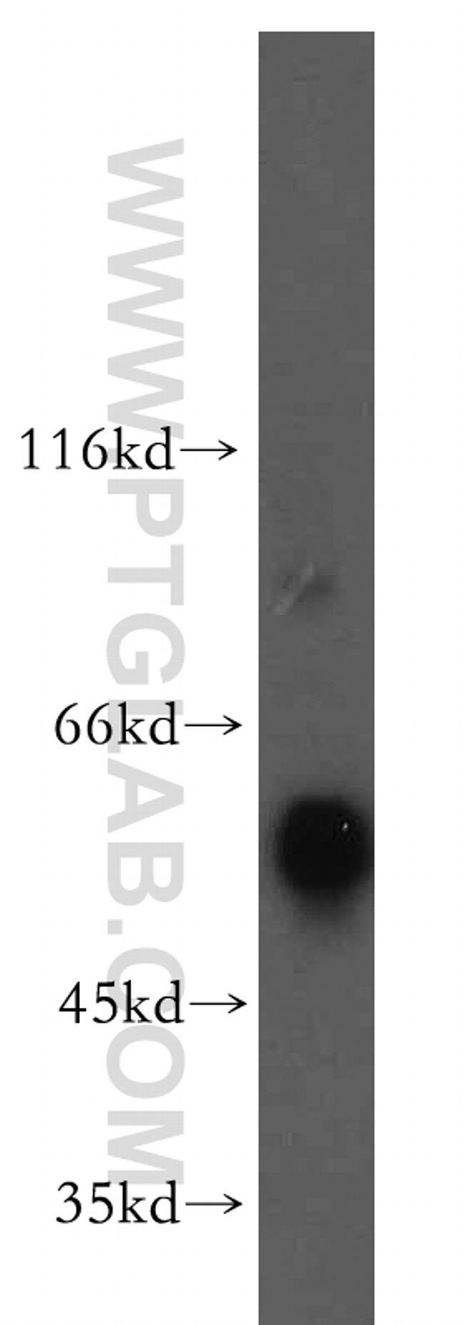 PRPF19 Antibody in Western Blot (WB)