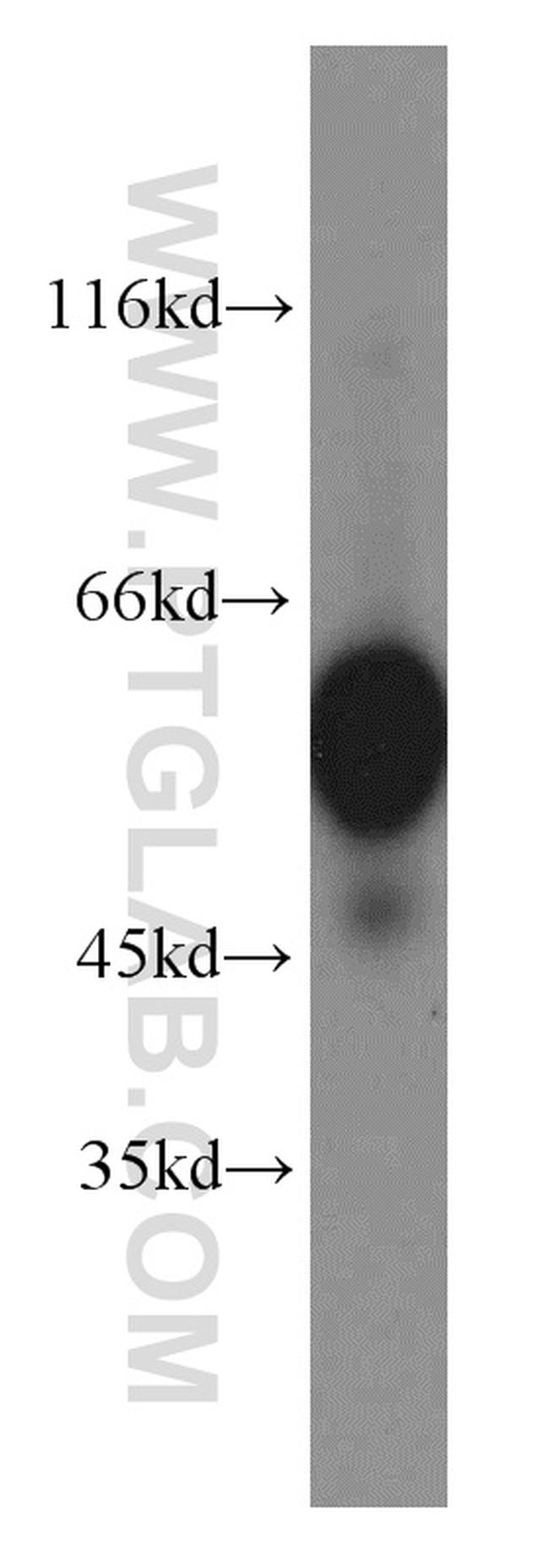 PRPF19 Antibody in Western Blot (WB)