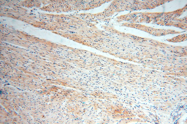 ANXA9 Antibody in Immunohistochemistry (Paraffin) (IHC (P))