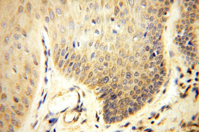 ANXA9 Antibody in Immunohistochemistry (Paraffin) (IHC (P))