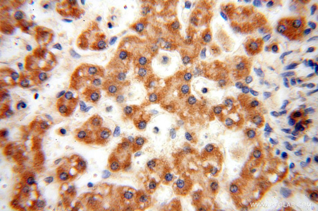 ANXA9 Antibody in Immunohistochemistry (Paraffin) (IHC (P))