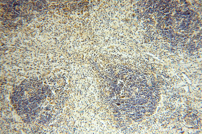 ANXA9 Antibody in Immunohistochemistry (Paraffin) (IHC (P))