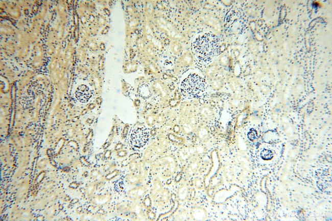 ANXA9 Antibody in Immunohistochemistry (Paraffin) (IHC (P))