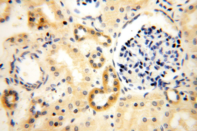 ANXA9 Antibody in Immunohistochemistry (Paraffin) (IHC (P))