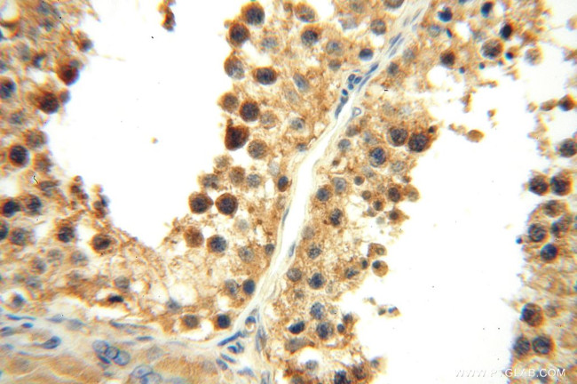 ANXA9 Antibody in Immunohistochemistry (Paraffin) (IHC (P))